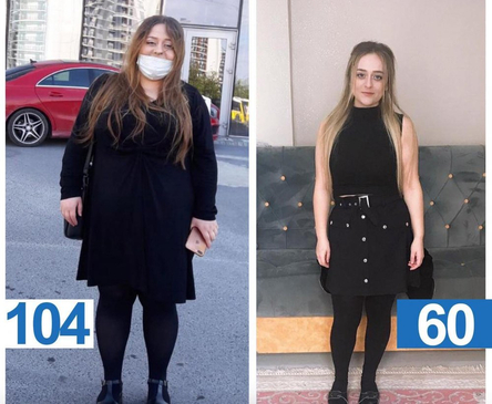 Slider image (6) Prof. MD. Umit Koc